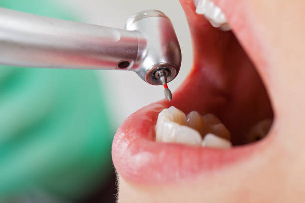 Best Emergency Dental Surgery in Fort Meade, MD